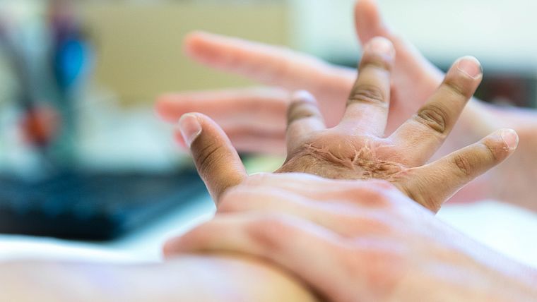 Nahaufnahme von Handtherapie